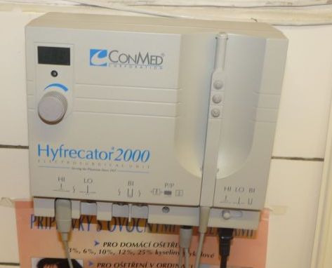 Hyfrecator 2000